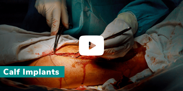 Calf implant surgery